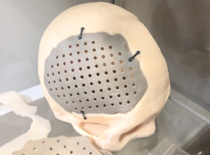 Die von Meditool hergestellten Implantate für die Neuro- und Wirbelsäulenchirurgie entstehen im 3D-Druck (Foto: Evonik)